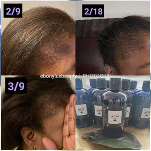 Hair Growth Stimulator Oil